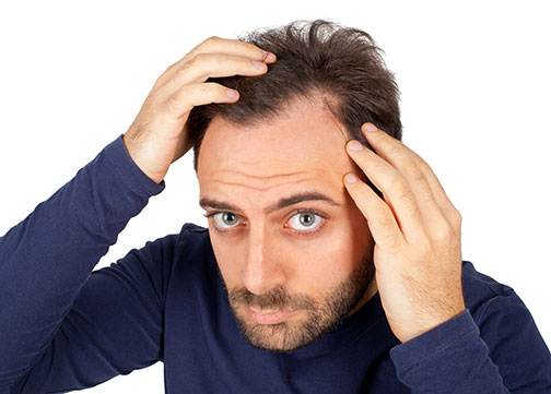 How to Improve Male Hair Loss