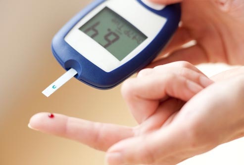 Top 20 Diabetes Mellitus Questions